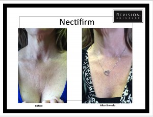 Revision Skincare in Charlotte, NC