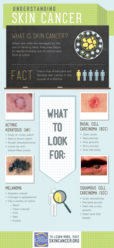 Understanding Skin Cancer  Darst Dermatology: Charlotte Dermatologist