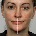 NuFACE® Facial Toning in Charlotte, NC